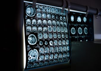 Hospital Estadual de Formosa amplia serviço de tomografia computadorizada em 2022