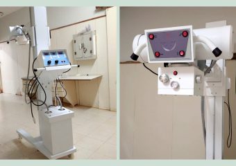 Hospital Regional de Formosa recebe novo aparelho de Raio-X