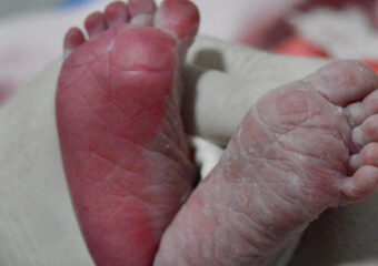 HEF ultrapassa mil partos humanizados e consolida referência regional em assistência materno-infantil