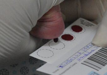 HEF reforça importância do Teste do Pezinho para diagnóstico precoce de doenças em recém-nascidos
