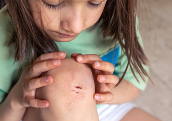 Hetrin alerta: férias escolares exigem atenção para prevenir acidentes domésticos com crianças